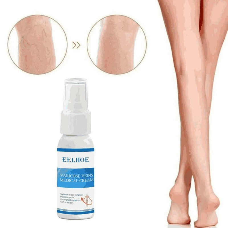 Varicose Vein Cream Spray Varicose Vein Legs and Varicose Vein Swelling L3g1 (Pack of 2)